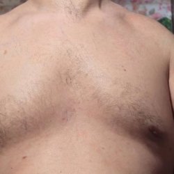 Chest