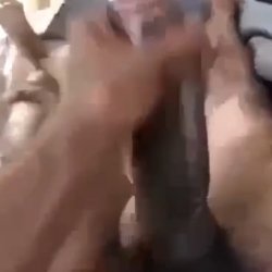 Stroke