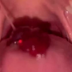 teen friend swallows gummy