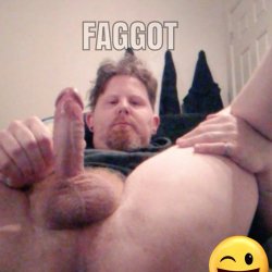 Exposed Fag