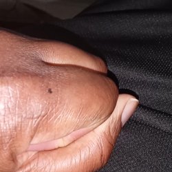 Penis flash