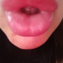 DSL LIPS FILLER