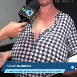 Gigantomastia  Ela não sabe mais o que fazer pois os seios não param de crescer  YouTube1080p