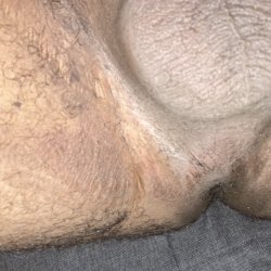 Need a bitch to eat this asshole real good 🇵🇷💦