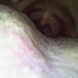 teen friend endoscope mouth tour