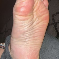 Big feet