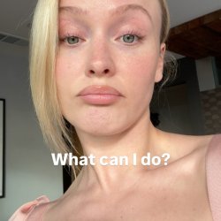 ZARA LARSSON | CELEBs